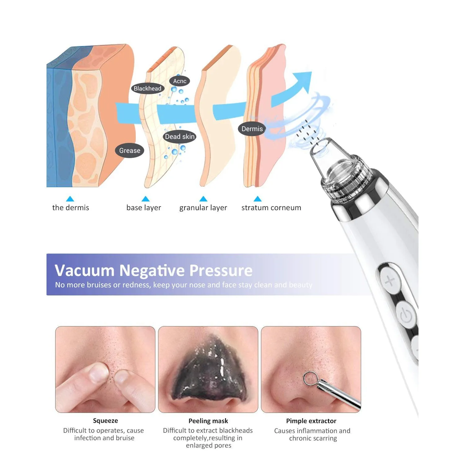 Blackhead Pore Vacuum Cleaner Remover