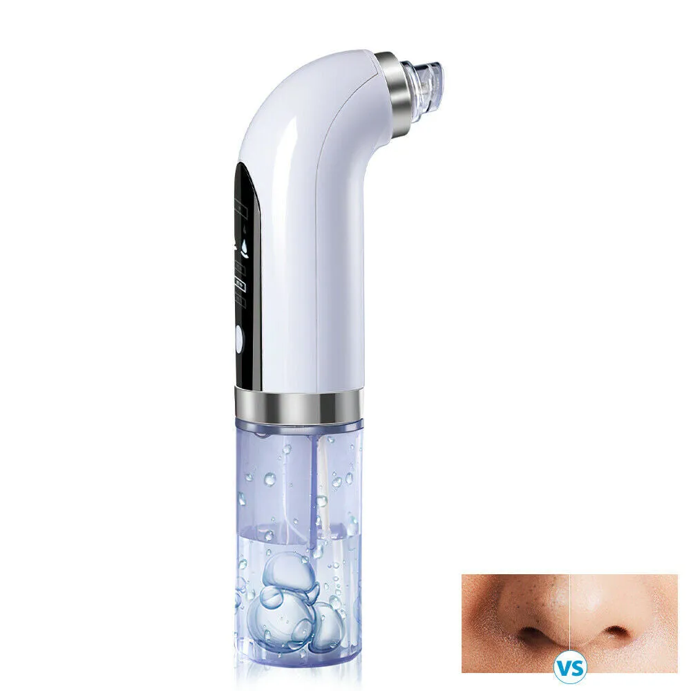 Blackhead Remover Vacuum Suction Pore Cleaner USB Facial Hydrodermabrasion